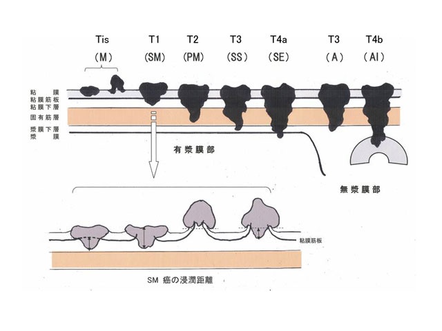 壁深達度（第8番）