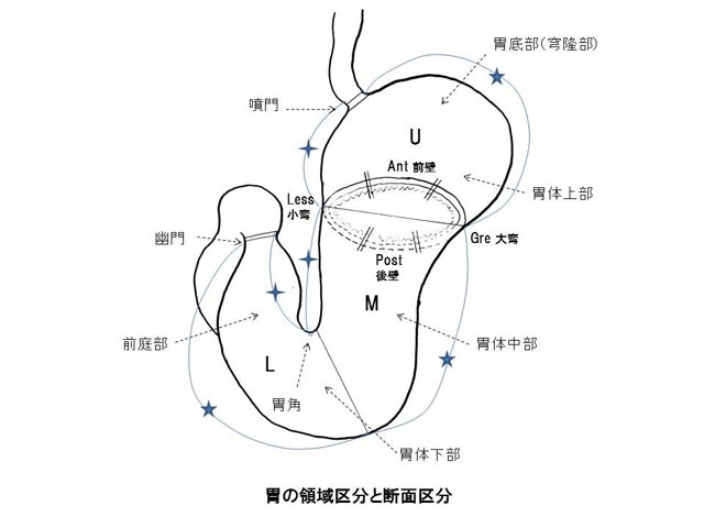 胃の領域区分と断面区分